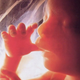 Image for article titled How to Build an Artificial Womb